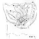 Fig. 04 - INFLATABLE MULTILEVEL VAGINAL PESSARY DEVICE
