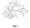 Fig. 02 - Mouthguard