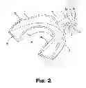Fig. 03 - Mouthguard