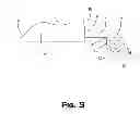 Fig. 04 - Mouthguard