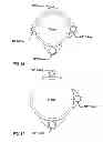 Fig. 28 - Heat transfer between tracer and pipe