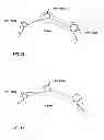 Fig. 29 - Heat transfer between tracer and pipe