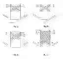 Fig. 05 - Method and means for producing textile materials comprising tape in two oblique orientations