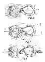 Fig. 04 - Universal covering system