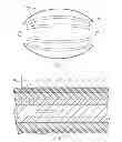 Fig. 02 - Method for microbial control of injection liquid flow in a hydrocarbon reservoir