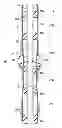 Fig. 01 - Method of completing a multi-zone fracture stimulation treatment of a wellbore