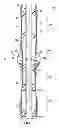 Fig. 02 - Method of completing a multi-zone fracture stimulation treatment of a wellbore