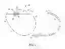 Fig. 02 - Feedthrough assembly for an implantable device