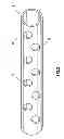 Fig. 03 - Method and apparatus for expendable tubing-conveyed perforating gun