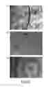 Fig. 07 - Bio-chip and method for separating and concentrating particles using the same