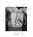 Fig. 03 - Reusable Packaging Bag for Absorbent Articles