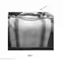 Fig. 04 - Reusable Packaging Bag for Absorbent Articles