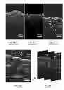 Fig. 07 - Forward-imaging optical coherence tomography (OCT) systems and probes