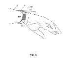 Fig. 09 - Bi-directionally operable, toolessly changeable, strap for a wearable display