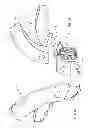 Fig. 22 - Skin stapler with components optimized for construction with plant based materials