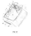 Fig. 09 - Surface cleaning apparatus with removable spray tip