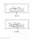 Fig. 04 - Wing root insert system for an aircraft family