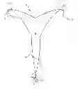 Fig. 01 - BALLOON FASTENER