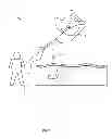 Fig. 02 - BALLOON FASTENER