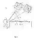 Fig. 09 - BALLOON FASTENER