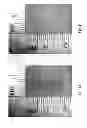 Fig. 02 - Matrix assisted laser desorption ionisation mass spectrometry imaging (MALDI-MSI)
