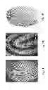 Fig. 03 - Matrix assisted laser desorption ionisation mass spectrometry imaging (MALDI-MSI)