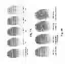 Fig. 04 - Matrix assisted laser desorption ionisation mass spectrometry imaging (MALDI-MSI)