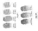 Fig. 05 - Matrix assisted laser desorption ionisation mass spectrometry imaging (MALDI-MSI)