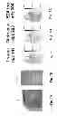 Fig. 10 - Matrix assisted laser desorption ionisation mass spectrometry imaging (MALDI-MSI)