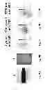 Fig. 12 - Matrix assisted laser desorption ionisation mass spectrometry imaging (MALDI-MSI)