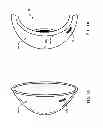 Fig. 02 - Assembling thin silicon chips on a contact lens