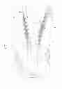 Fig. 02 - SURGICAL NEEDLE DRIVER AND METHOD OF MAKING THE SAME