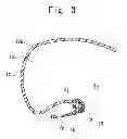 Fig. 04 - Sealing structure of fuel inlet box
