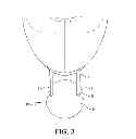 Fig. 04 - Ball pick