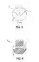 Fig. 06 - Ball pick