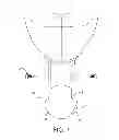 Fig. 07 - Ball pick