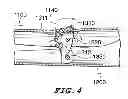 Fig. 04 - Locking tong