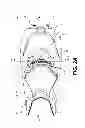 Fig. 04 - Backrest for a straddle-seat vehicle