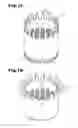 Fig. 12 - COMMUTATOR