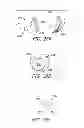 Fig. 08 - APPARATUS AND METHODS FOR CHARGING AN IMPLANTED MEDICAL DEVICE POWER SOURCE