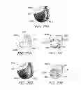 Fig. 09 - APPARATUS AND METHODS FOR CHARGING AN IMPLANTED MEDICAL DEVICE POWER SOURCE