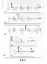 Fig. 02 - CIRCUITS AND METHODS FOR EFFICIENT CLOCK AND DATA DELAY CONFIGURATION FOR FASTER TIMING CLOSURE
