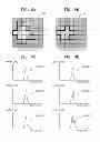 Fig. 08 - Method and apparatus for removing distortion by lipids from magnetic resonance image