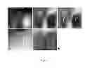 Fig. 09 - Systems and methods for thermophotonic dynamic imaging