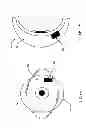 Fig. 02 - CONTACT LENS HAVING A CHIP INTEGRATED INTO A POLYMER SUBSTRATE AND METHOD OF MANUFACTURE