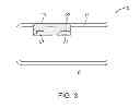 Fig. 04 - Camera light source mounting structures