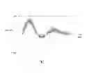 Fig. 08 - Ultrasound image processing apparatus and program