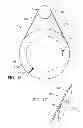 Fig. 11 - Clocks with uniquely driven elements which are interpreted by the use of traditional clock interpretation methods