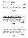 Fig. 04 - Pre-compensated optical tape wobble patterns