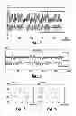 Fig. 06 - Pre-compensated optical tape wobble patterns